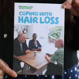Coping with hairloss